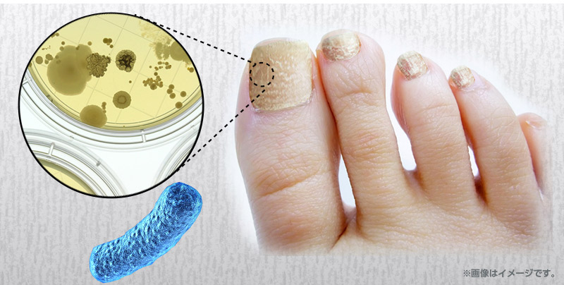 %e3%82%af%e3%83%aa%e3%82%a2%e3%83%8d%e3%82%a4%e3%83%ab%e3%82%b7%e3%83%a7%e3%83%83%e3%83%880919002